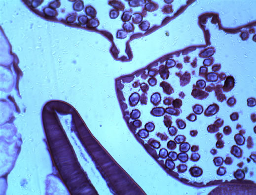 Ascaride osservato attraverso microscopio biologico a 100 ingrandimenti.